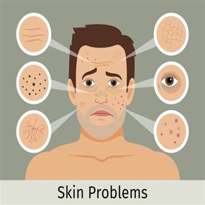 Skin Problems Boys