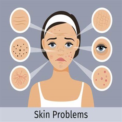 Skin Problems Girls